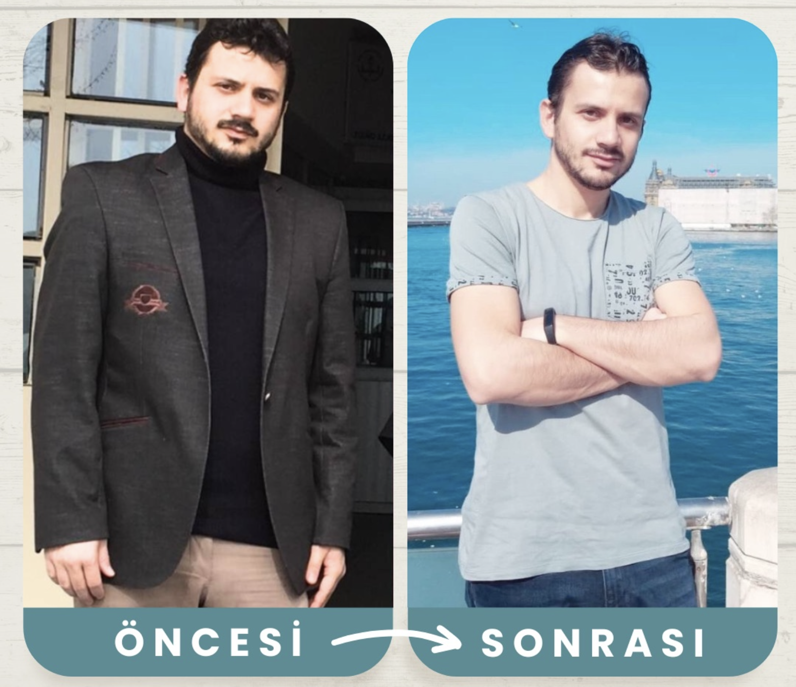 Önce/Sonra